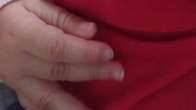 Bebê de 7 meses é internado com costela quebrada e lesão no crânio; mãe é presa