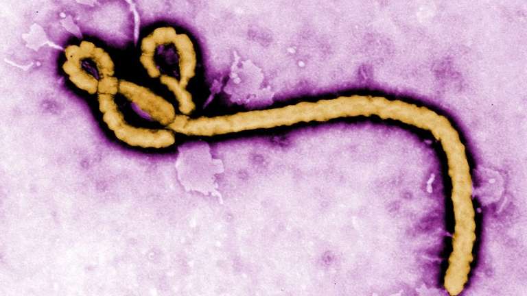 Caso suspeito de ebola em idoso é investigado no Rio Grande do Sul