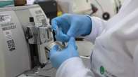 SUS disponibiliza um novo tratamento para leucemia mieloide em adultos; entenda