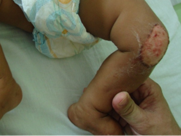 MÃ£e Ã© suspeita de maus-tratos contra bebÃª de seis meses, diz polÃ­cia