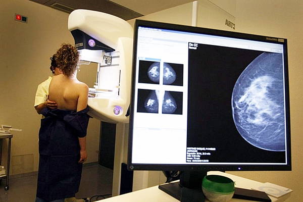 Demora no diagnÃ³stico de cÃ¢ncer leva Ã  mastectomia em 70% dos casos