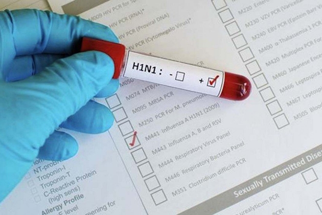 Gripe faz duas novas vÃ­timas e nÃºmero de mortes sobe para 33 em MS