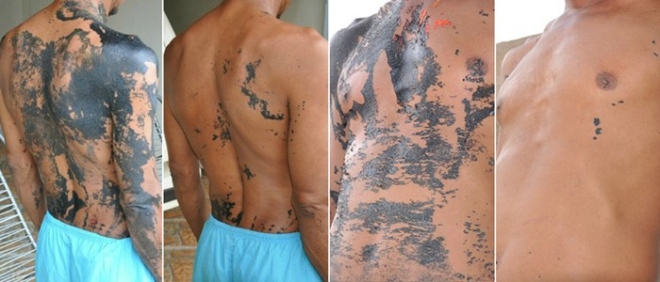 Poderia ter matado, diz mÃ©dico sobre homem pintado por colegas