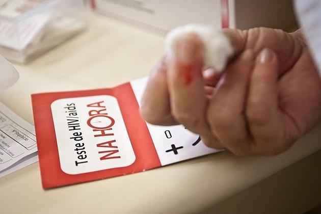 MinistÃ©rio da SaÃºde: 135 mil convivem com HIV no paÃ­s e nÃ£o sabem