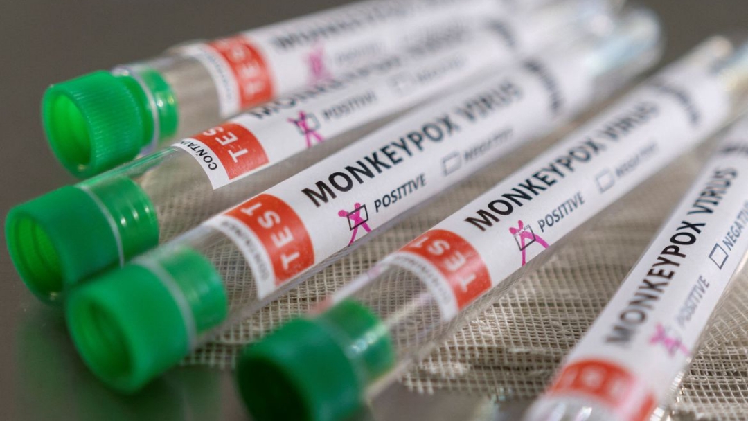 Brasil tem 106 casos de var&iacute;ola dos macacos confirmados