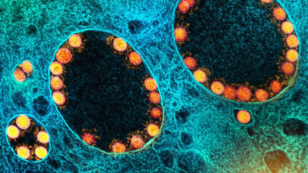 Pesquisa mostra efic&aacute;cia da vitamina B12 para atenuar covid-19