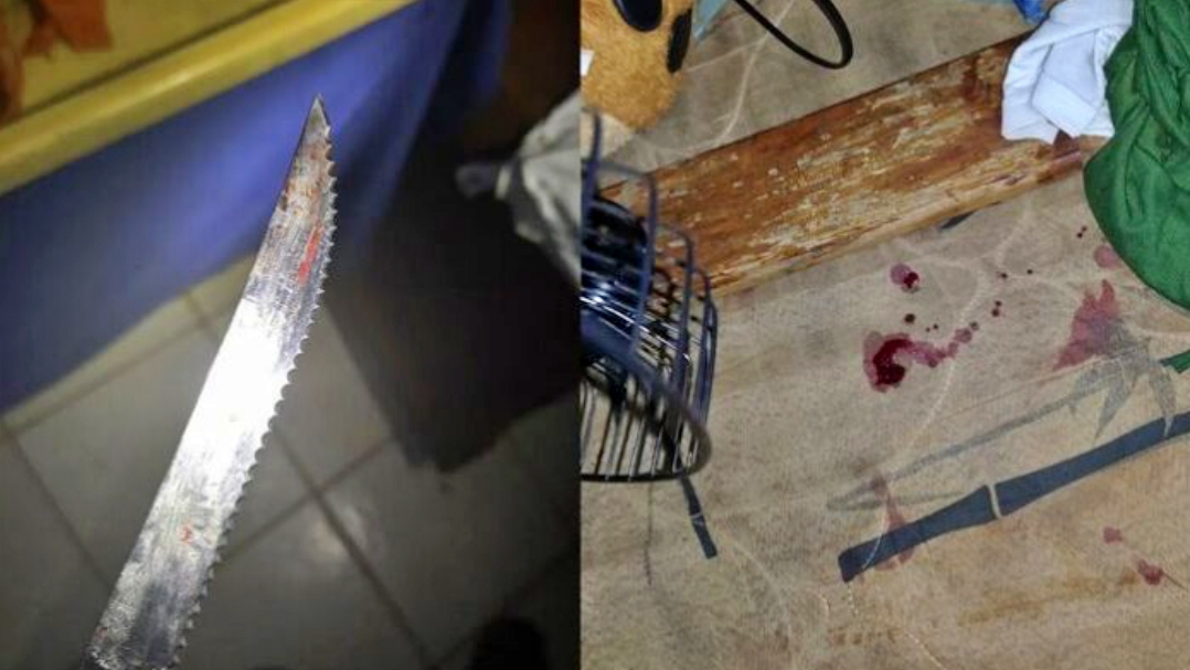 Mulher fica em estado grave ap&oacute;s levar facada da filha em ch&aacute;cara