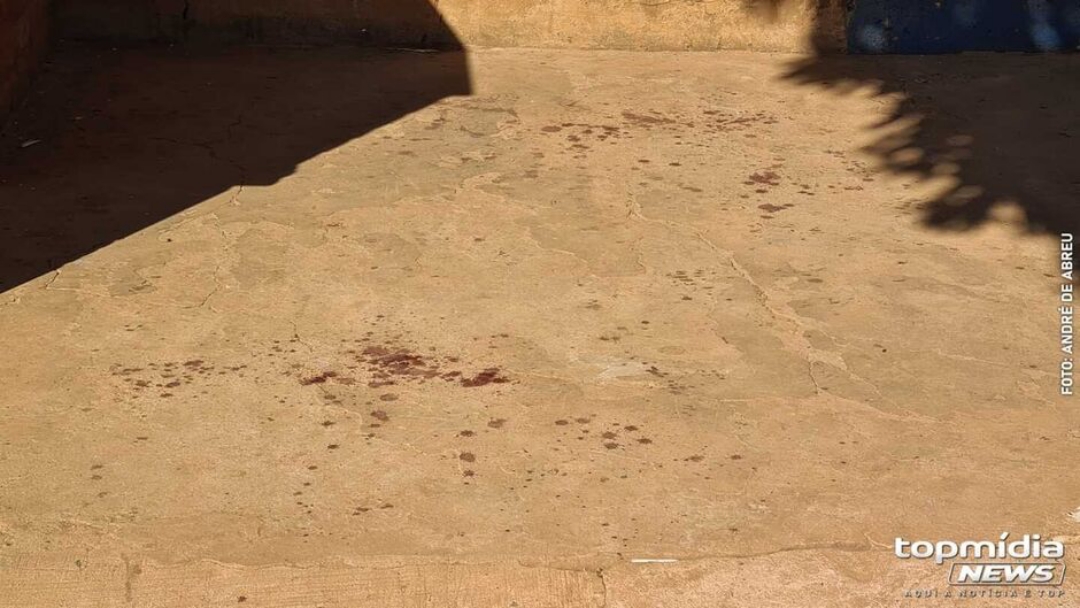 Pai se irrita com som alto e d&aacute; facada na cabe&ccedil;a do pr&oacute;prio filho no DF