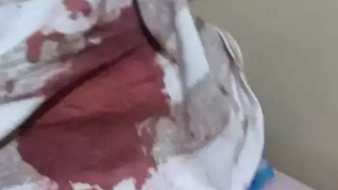 Tio d&aacute; 15 facadas no pesco&ccedil;o do sobrinho de 3 anos 