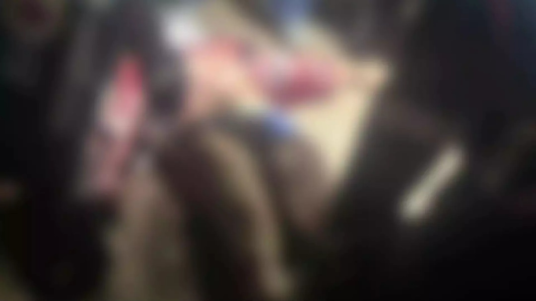 Atacado por 3 pit bulls, rapaz sai do coma e deve passar por terceira cirurgia em Campo Grande