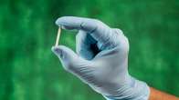 Contraceptivo de longa dura&ccedil;&atilde;o, Implanon ser&aacute; incorporado ao SUS em 2025
