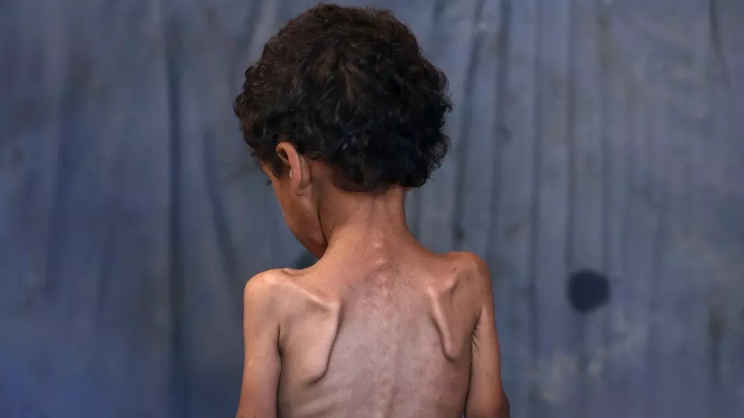 Mais 9 pessoas morrem de fome em Gaza e Israel promete liberar entrega de ajuda por via a&eacute;rea