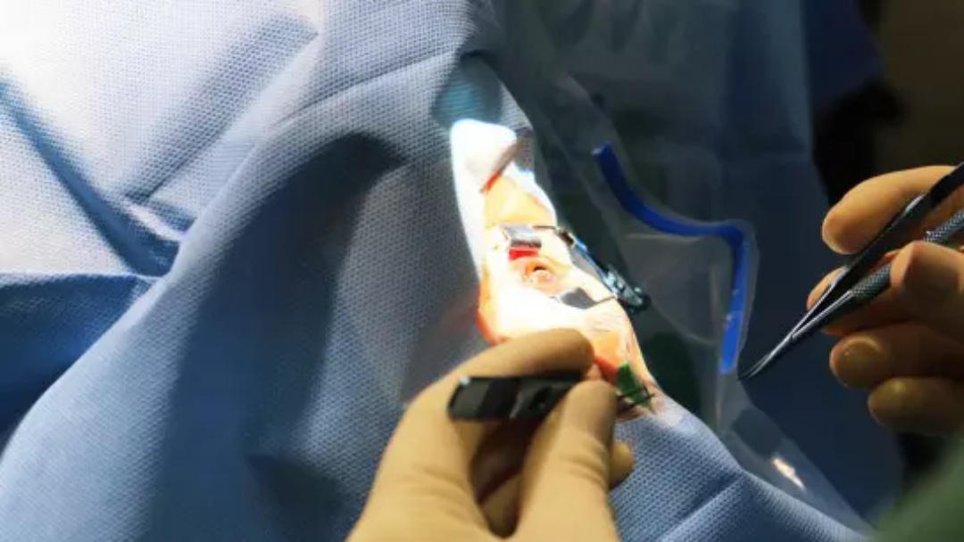 Fila por transplante de c&oacute;rnea no Brasil dobra em uma d&eacute;cada