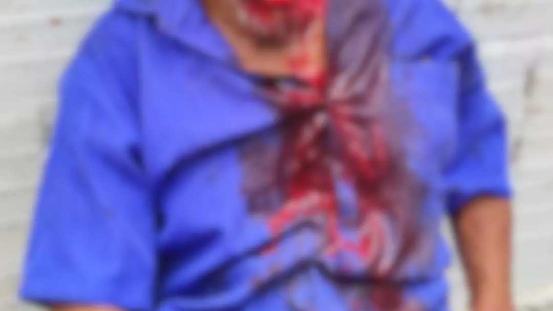 Ataque de pitbull deixa idoso desfigurado e em estado grave 