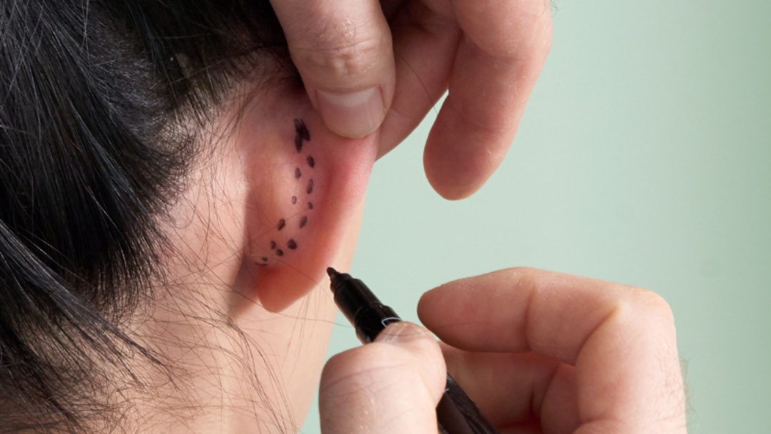 Hospital Dona Elm&iacute;ria abre agenda para cirurgias de estrabismo e otoplastia