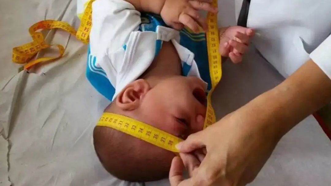 V&iacute;timas do zika ter&atilde;o R$ 50 mil em indeniza&ccedil;&atilde;o e pens&atilde;o vital&iacute;cia