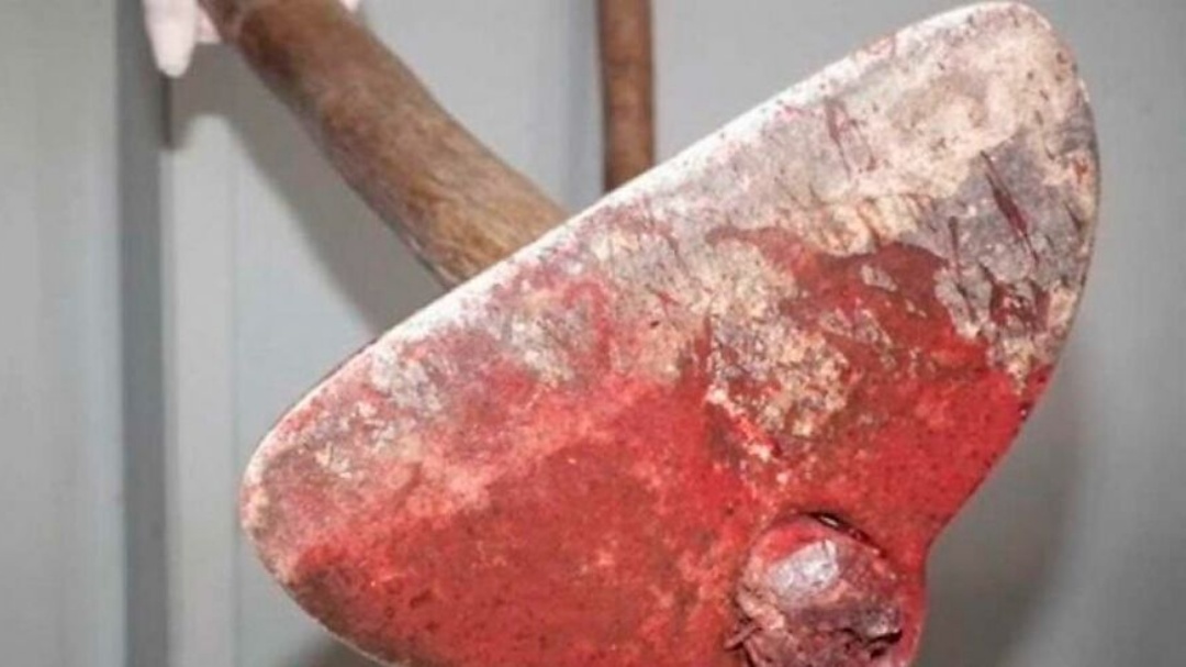 Trabalhador rural &eacute; agredido com enxadada na cabe&ccedil;a durante briga com pe&atilde;o 