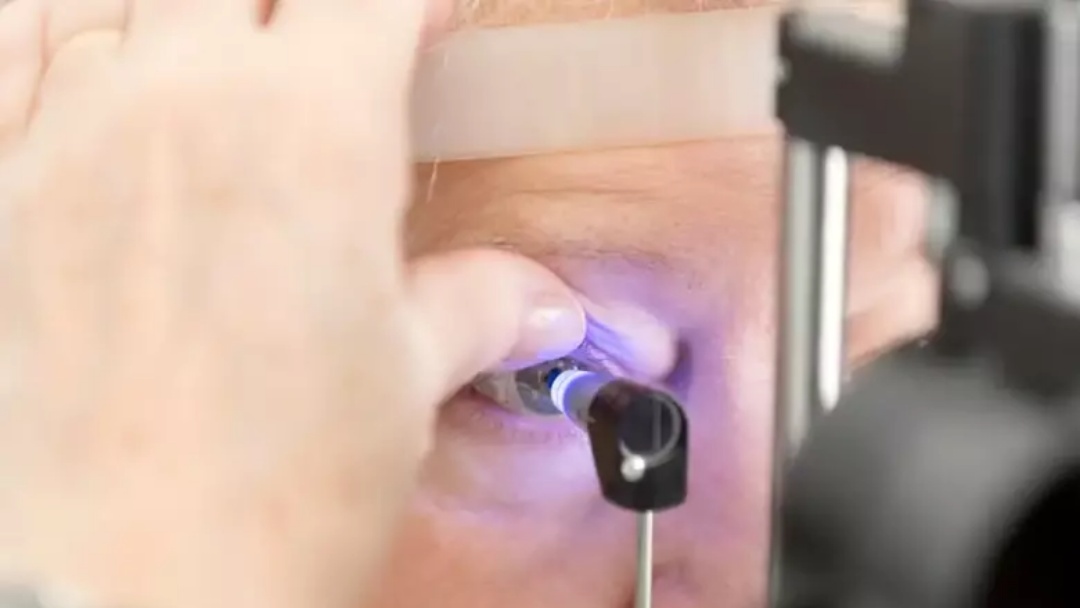 Intoxica&ccedil;&atilde;o por metanol pode causar cegueira, alerta associa&ccedil;&atilde;o