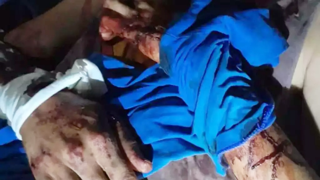 Onça-pintada deixa um trabalhador rural em estado grave no Pantanal do Paiaguás