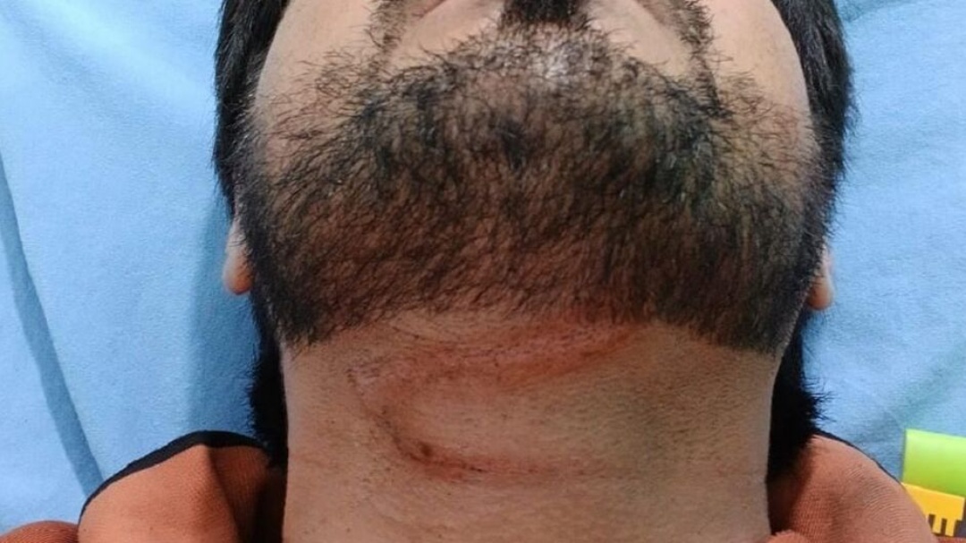 Motoentregador fica ferido ao enroscar em fio de internet em Chapad&atilde;o do Sul   