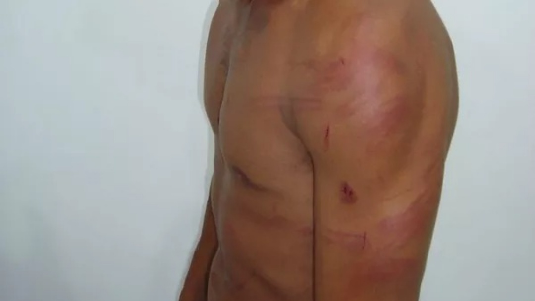 Mulher bate no ex durante conversa sobre rela&ccedil;&otilde;es p&oacute;s-t&eacute;rmino no Maria Aparecida Pedrossian   