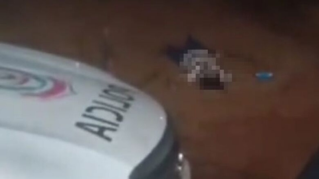 Mulher morre com tiro na cabe&ccedil;a ao tentar separar briga