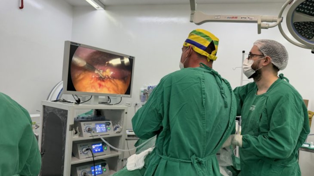 HR de Ponta Por&atilde; realiza 1&ordf; cirurgia por videolaparoscopia e marca avan&ccedil;o na assist&ecirc;ncia cir&uacute;rgica