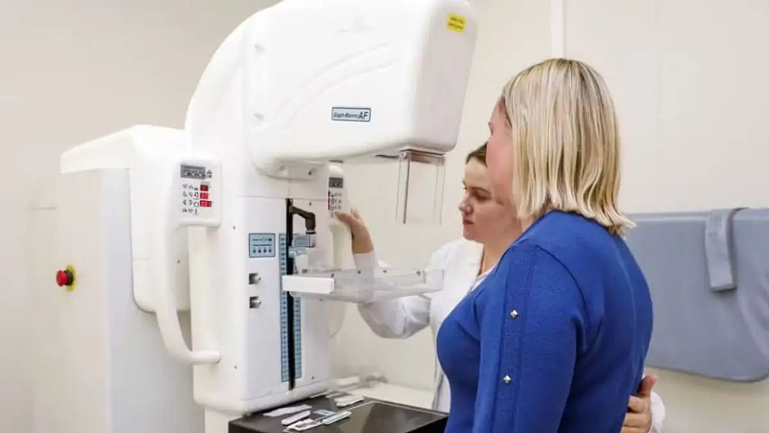 Senado aprova mamografia pelo SUS para mulheres a partir dos 40 anos