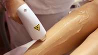 Domingo e Segunda tem depila&ccedil;&atilde;o a laser com Dayanne Kommers; veja os benef&iacute;cios e outros tratamentos dispon&iacute;veis