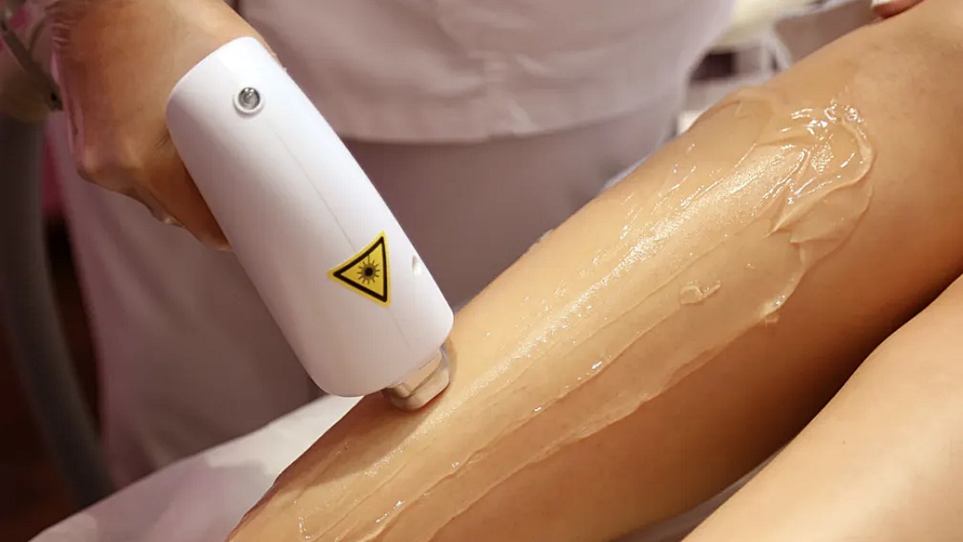 Domingo e Segunda tem depila&ccedil;&atilde;o a laser com Dayanne Kommers; veja os benef&iacute;cios e outros tratamentos dispon&iacute;veis