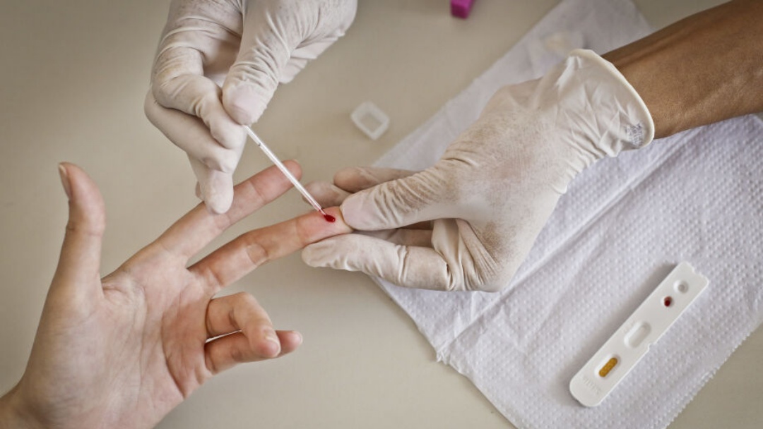 Mato Grosso do Sul tem redução de 4% nas mortes por aids em 12 meses