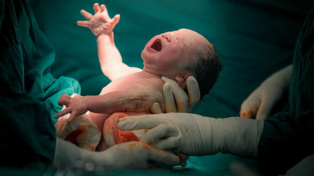 IBGE mostra que queda da natalidade em Sidrolândia foi 310% maior que a média estadual