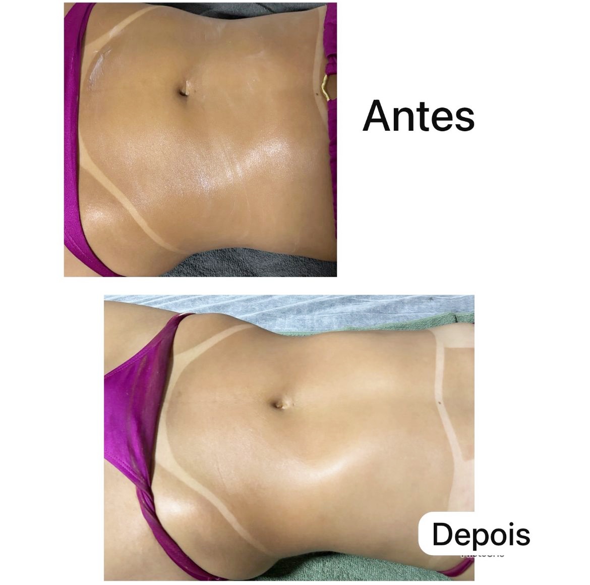 Exagerou nas comidas de fim de ano? Combo corporal promete resultados vis&iacute;veis e recupera&ccedil;&atilde;o das medidas