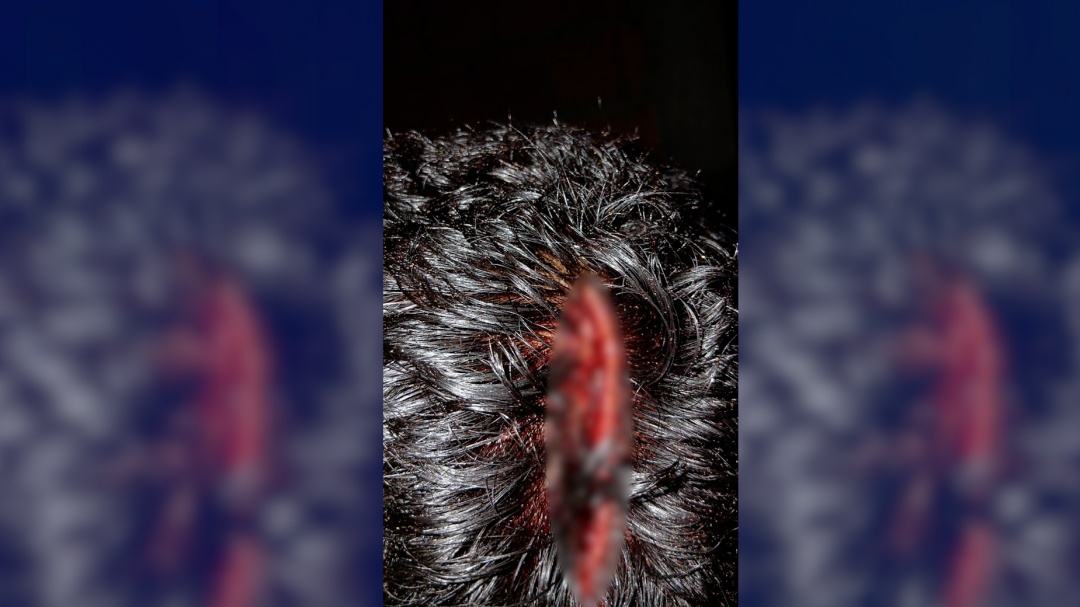 H&oacute;spedes estrangeiros v&atilde;o para hotel, deixam pitbull solto e animal ataca idoso em Corumb&aacute;