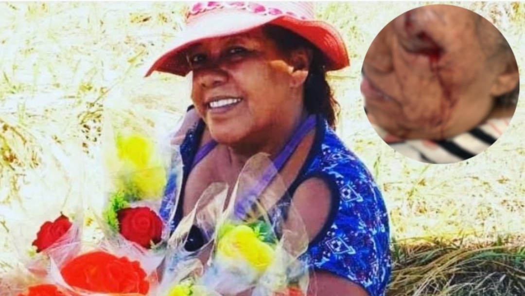 Florista &eacute; atingida por estilha&ccedil;os de bomba em Campo Grande e corre risco de perder a vis&atilde;o