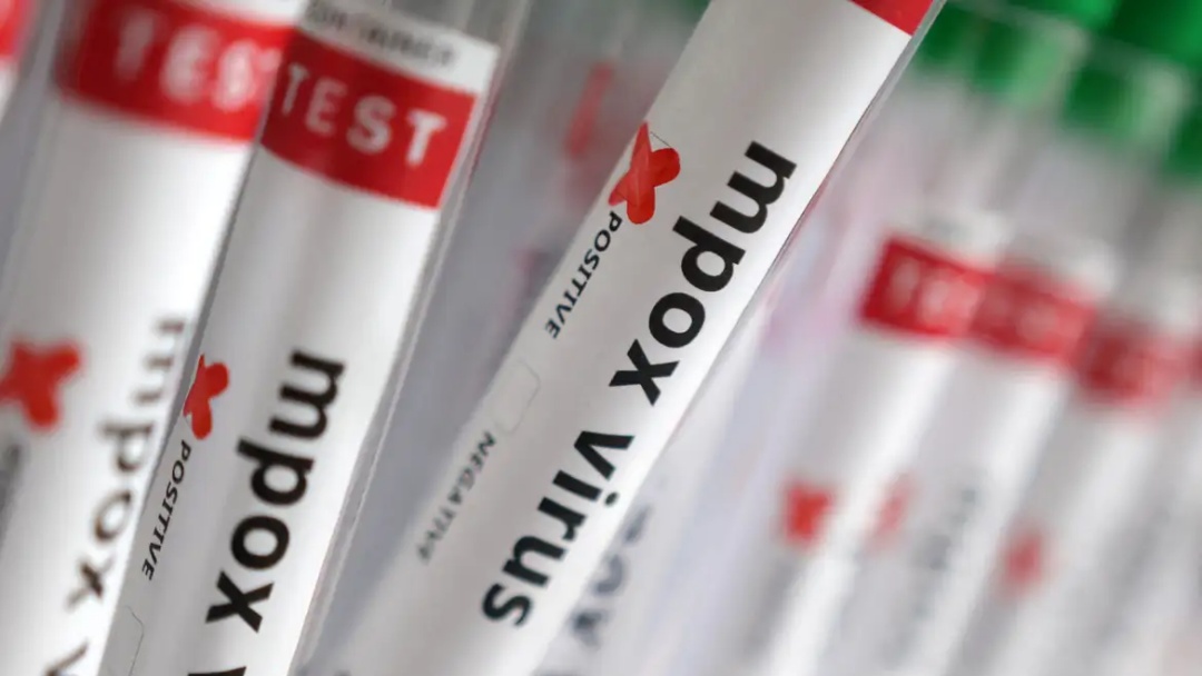 Sobe para 140 n&uacute;mero de casos confirmados de Mpox no pa&iacute;s, em 2026