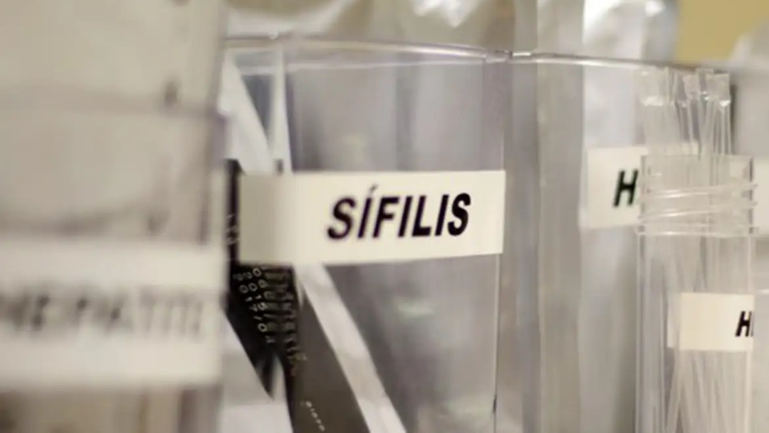 SUS passa a adotar antibi&oacute;tico para prevenir s&iacute;filis e clam&iacute;dia