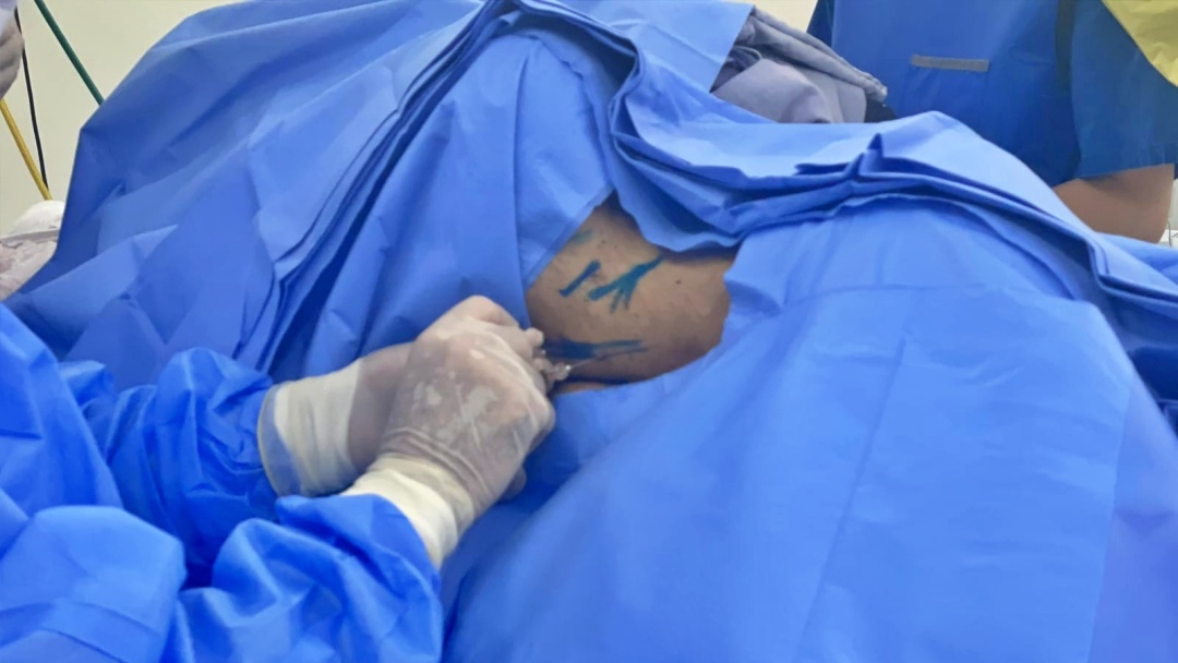 Morador de Sidrol&acirc;ndia passa por cirurgia in&eacute;dita e reacende esperan&ccedil;a de voltar a andar