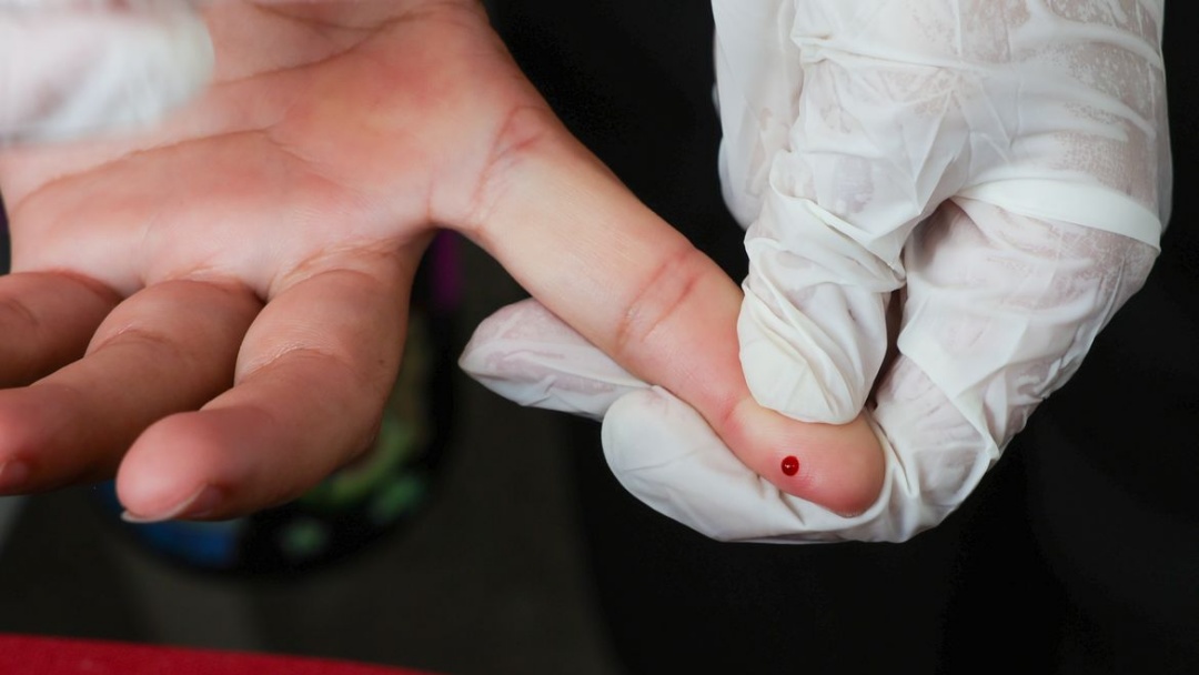 Teste rápido de dengue passa a integrar tabela do SUS