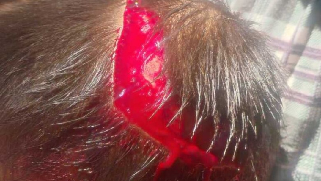 M&atilde;e embriagada &eacute; suspeita de agredir crian&ccedil;a de 2 anos 