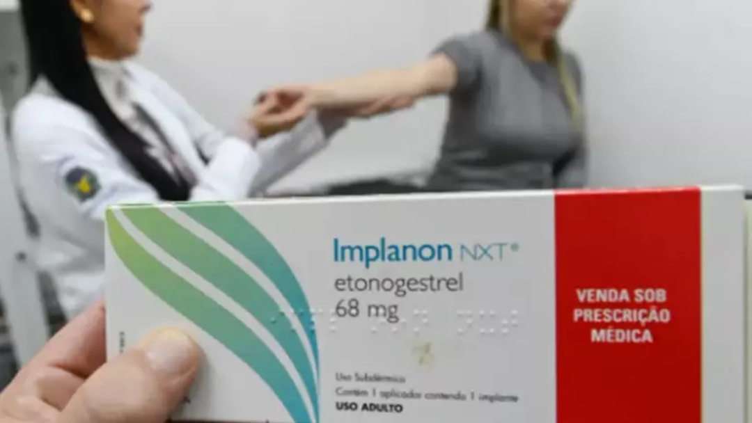 SUS qualifica profissionais para ampliar as ofertas de implantes hormonais