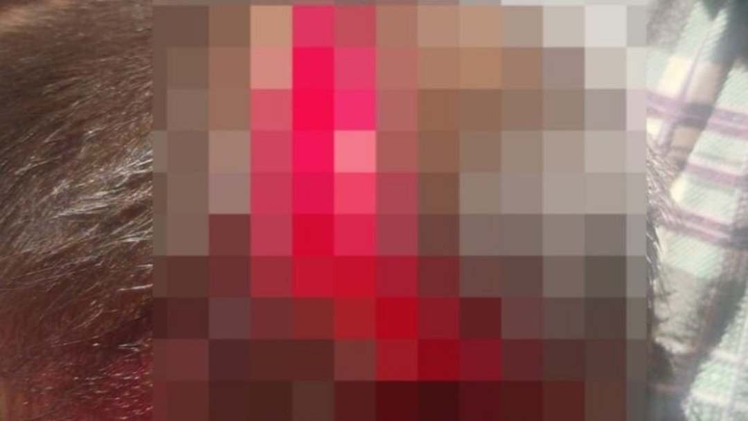 Justi&ccedil;a mant&eacute;m pris&atilde;o de mulher que agrediu filho em Dourados