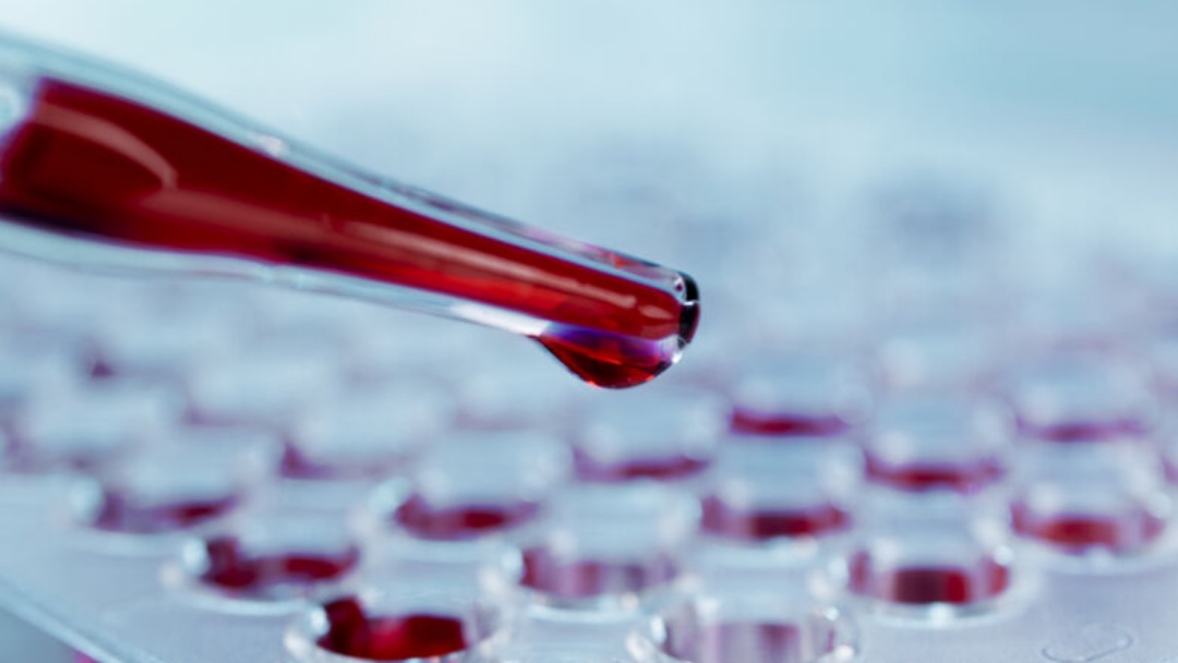 Estudo da Fiocruz pode ampliar preven&ccedil;&atilde;o do HIV em jovens