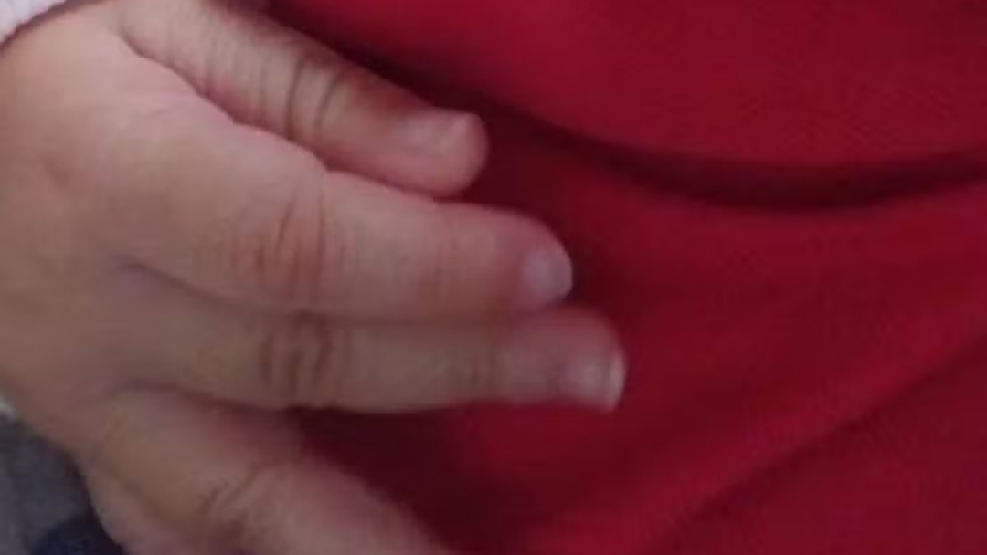 Beb&ecirc; de 7 meses &eacute; internado com costela quebrada e les&atilde;o no cr&acirc;nio; m&atilde;e &eacute; presa 