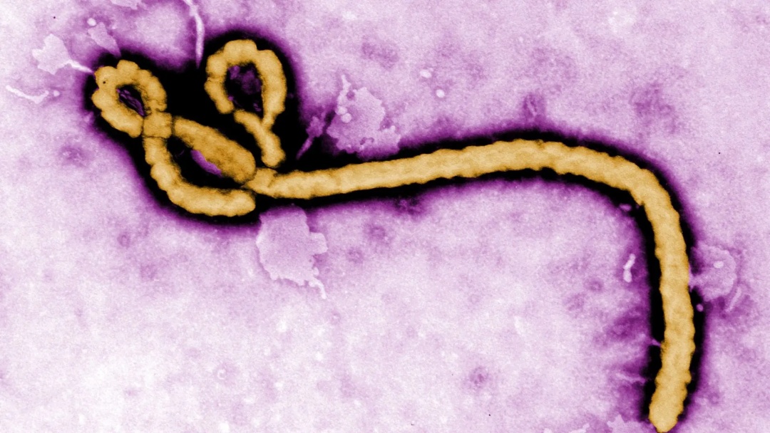 Caso suspeito de ebola em idoso é investigado no Rio Grande do Sul