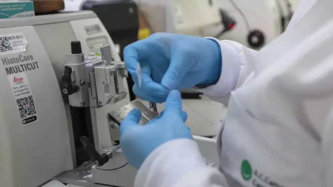 SUS disponibiliza um novo tratamento para leucemia mieloide em adultos; entenda